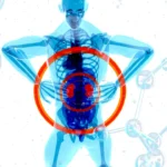 Perché si formano i calcoli renali? Le cause principali